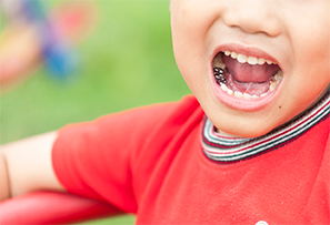 types of dental crowns